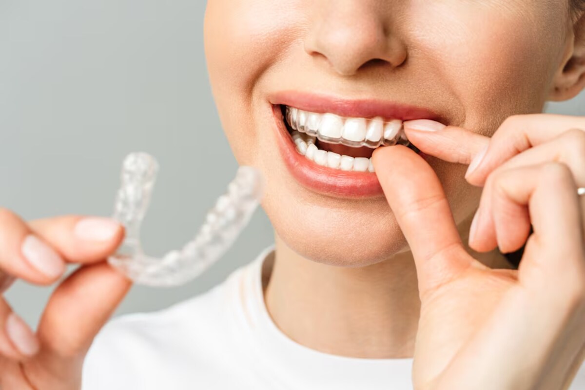 is invisalign right for you pros and cons